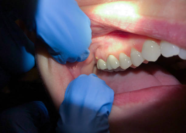 Best Broken or Cracked Tooth Emergency Dentist in Leisure Knoll, NJ
